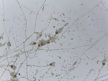 Penisilyum küf fırça benzeri konidiyoforun ve oval sporların mikroskobik görüntüsü.