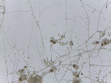 Penisilyum küf fırça benzeri konidiyoforun ve oval sporların mikroskobik görüntüsü.