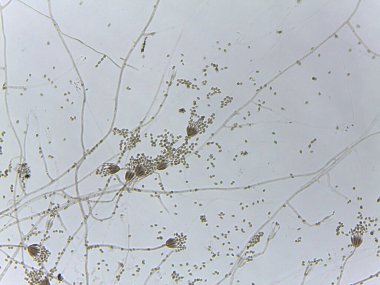 Penisilyum küf fırça benzeri konidiyoforun ve oval sporların mikroskobik görüntüsü.