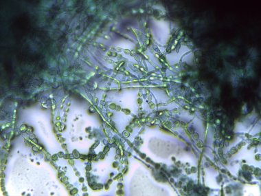 Yoğun bir ağda iç içe geçmiş septik ve dematiasöz mantar hifabesini gösteren mikrograf.