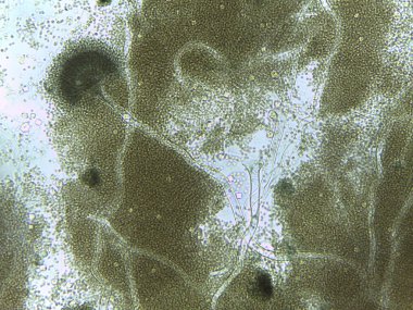 Mikroskobik Aspergillus konidiyoforları, ortama bol miktarda spor salar..