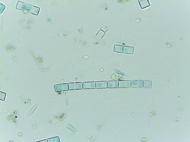 Auxospore oluşumunu gösteren mikroskobik Diatom Melosira Görünümü.