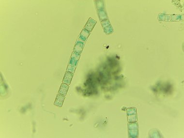 Auxospore oluşumunu gösteren mikroskobik Diatom Melosira Görünümü.