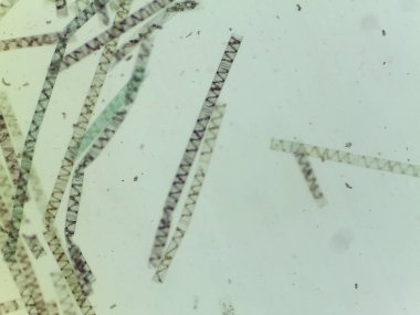 Mikroskobik Yeşil Yosun Görünümü, Spirogyra, Spiral Kloroplastlar