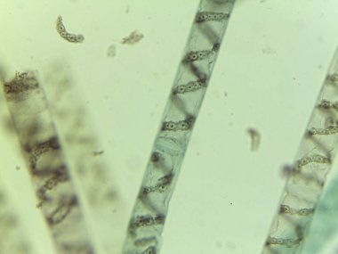 Mikroskobik Yeşil Yosun Görünümü, Spirogyra, Spiral Kloroplastlar
