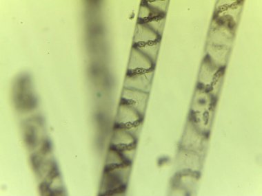Mikroskobik Yeşil Yosun Görünümü, Spirogyra, Spiral Kloroplastlar