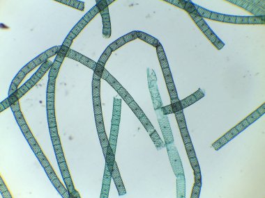 Çoklu Spirogyra İplikleri 'nin mikroskobik Görünümü Segmentli Hücreleri ve Spiral Kloroplastları Gösteriyor