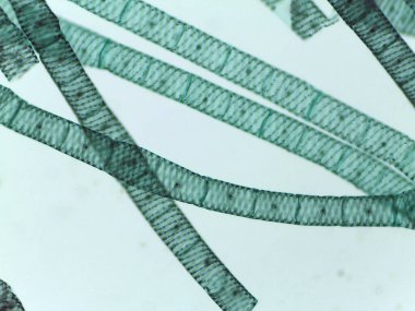 Çoklu Spirogyra İplikleri 'nin mikroskobik Görünümü Segmentli Hücreleri ve Spiral Kloroplastları Gösteriyor
