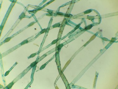 Mikroskobik Yeşil Yosun Görünümü, Pithophora, Akinetes Gösterimi