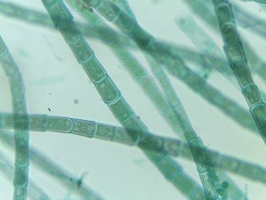 Potansiyel Cüce İplikçikleri ile mikroskobik Filamentous Algler (Oedogonium) Görünümü