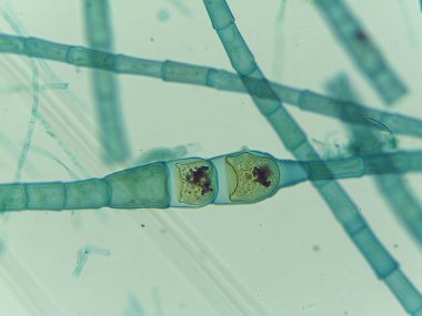 Potansiyel Cüce İplikçikleri ile mikroskobik Filamentous Algler (Oedogonium) Görünümü