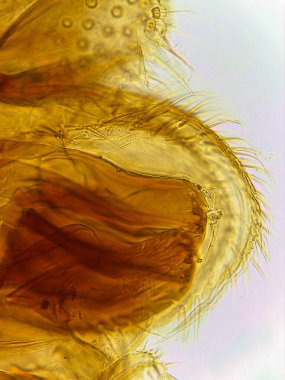 Bir Erkek Pirenin (Pulex irritans) mikroskobik Yanal Görünümü)