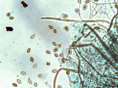 Çeşitli spor ve mantar yapılarının mikroskobik görünümü, karmaşık detaylar ve dokular sergilenir