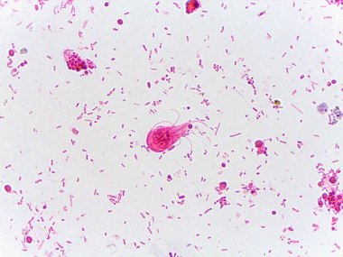 Bakterilerle çevrili mikroskobik Giardia lamblia trophozoiti görüntüsü.