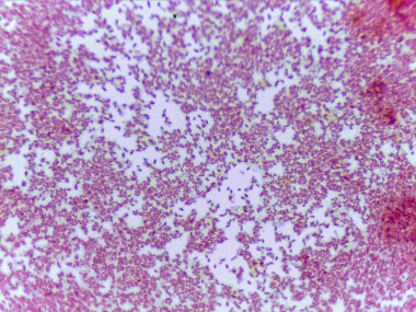 Bir slayttaki mikroskobik bakteri kolonileri görüntüsü, çeşitli şekil ve boyutları gösteriyor, pembe-mor renkli bir leke hücreleri vurguluyor.