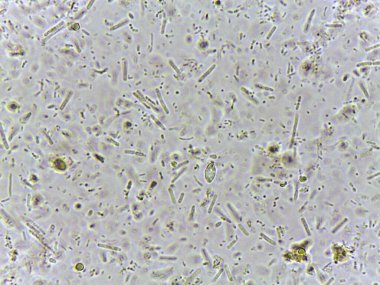 Bakteri ve algler dahil çeşitli mikroorganizmaların mikroskobik görünümü