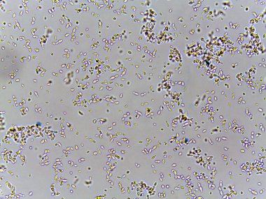 Bir sıvının içindeki mikroskobik görüntüler, çeşitli şekil ve boyutları gösteren bulanık bir arka plan.