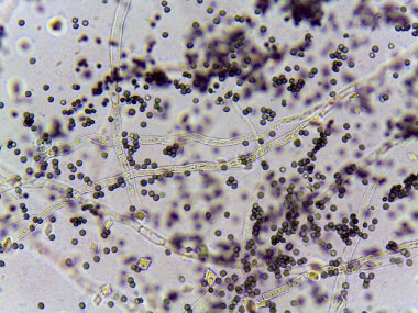 Bakteri ve mantar yapılarının mikroskobik görüntüsü, bir lif ağı ve sayısız küçük yuvarlak hücre gösteriyor