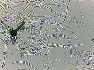 Mikroskobik görünüme göre lifli yapılar ve küresel hücreler, mikro organizmaların karmaşık detaylarını gösteriyor.