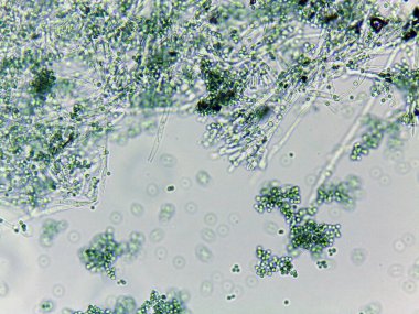 Yeşil algler ve mikroorganizmaların mikroskobik görüntüsü, karmaşık yapılar ve dokular sergiliyor.