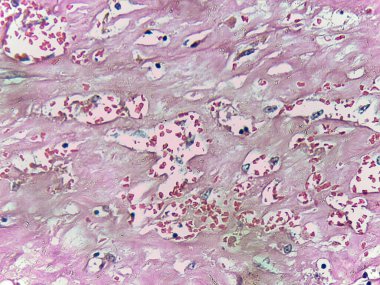 Pembe ve mor lekeli dokunun mikroskobik görüntüsü hücreleri ve çekirdekleri gösteriyor