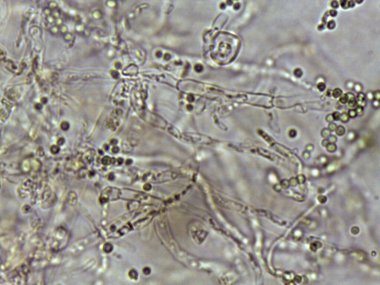 Mantar hyphae ve sporların mikroskobik görüntüsü, karmaşık yapılar ve dokular sergiliyor.