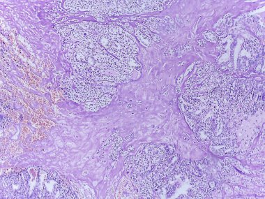 Analiz için boyanmış hücresel yapıları ve desenleri gösteren mikroskobik doku örneği görüntüsü