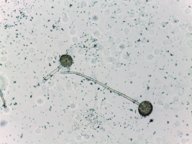 İki küresel mikroorganizmanın mikroskobik görüntüsü, daha küçük parçacıklarla çevrili bir filamanla birbirine bağlı.