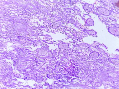 Mor renklerle boyanmış çeşitli hücre yapılarını ve desenlerini gösteren mikroskobik doku örneği
