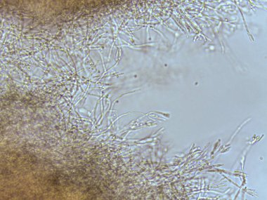 Yumuşak odaklı arka plan ile mantar hyphae veya yosun benzeri lifli yapıların mikroskobik görünümü