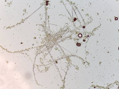 Sıvı bir ortamda yaşayan alglere veya mikroorganizmalara benzeyen lifli yapı ve parçacıkların mikroskobik görünümü