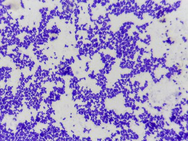 Beyaz zemin üzerinde mor lekeli bakterilerin mikroskobik görünümü