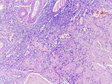 Hücresel yapıları ve boyama şekillerini gösteren doku örneklerinin mikroskobik görünümü