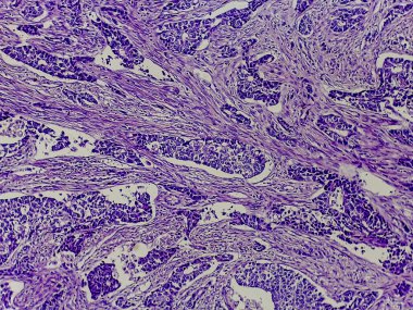 Mor lekeli dokunun mikroskobik görüntüsü, hücresel yapıları ve kalıpları gösteriyor, biyolojik veya tıbbi araştırmaların göstergesi.