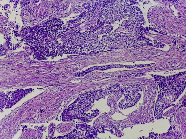 İnceleme için boyanmış hücresel yapıları ve desenleri gösteren mikroskobik doku görüntüsü