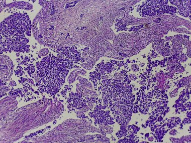 Analiz için boyanmış çeşitli hücre tiplerini ve yapılarını gösteren doku örneklerinin mikroskobik görünümü