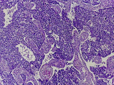 İnceleme için boyanmış hücresel yapıları ve desenleri gösteren mikroskobik doku görüntüsü