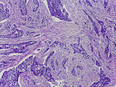 Karmaşık hücresel yapılara sahip dokunun mikroskobik görüntüsü, ağırlıklı olarak mor renklerde çeşitli hücre tipleri ve desenlerini gösteriyor.