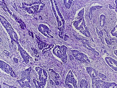 Mor lekeli dokunun mikroskobik görüntüsü, karmaşık yapılar ve hücresel desenler gösteriyor, biyolojik veya tıbbi araştırmaların göstergesi.