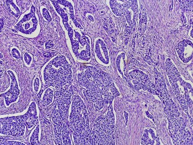 Mor lekeli dokunun mikroskobik görüntüsü, hücresel yapıları ve kalıpları gösteriyor, biyolojik veya tıbbi araştırmaların göstergesi.