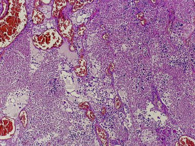 Çeşitli hücresel yapılara sahip dokuların mikroskobik bir görüntüsü, kırmızı ve mor lekelerin bir karışımını gösteriyor, biyolojik örneklerin göstergesi, muhtemelen araştırma veya eğitim amaçlı.