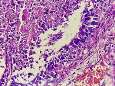 Çeşitli hücre tiplerine sahip dokuların mikroskobik görünümü, karmaşık yapıları ve lekeleme kalıplarını gösterir, hücresel detayları ve organizasyonu vurgular