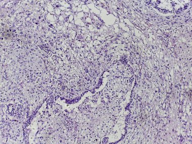 Mor lekeli dokunun mikroskobik görüntüsü hücresel yapıları ve kalıpları gösteriyor, muhtemelen tıbbi ya da bilimsel analiz için.