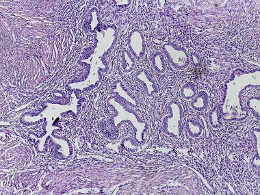 İnceleme için lekelenmiş karmaşık yapıları ve hücresel düzenlemeleri gösteren mikroskobik doku örneği