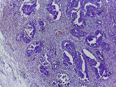 Mor lekeli dokunun mikroskobik görüntüsü, hücresel yapıları ve kalıpları gösteriyor, biyolojik veya tıbbi araştırmaların göstergesi.