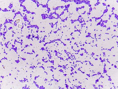 Işık zemininde mor lekeli bakterilerin mikroskobik görüntüsü, çeşitli şekil ve boyutlarda