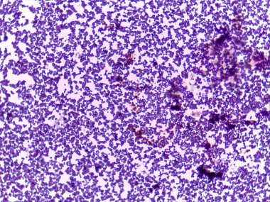 Biyolojik bir örneğin mikroskobik görüntüsü mor renkli sayısız hücre ve yapıyı gösterir
