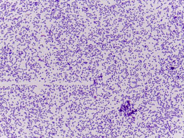 Işık arkaplanındaki sayısız küçük mor noktanın mikroskobik görüntüsü, bakteri veya hücrelere benzer.