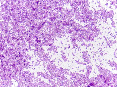 Mor lekeli hücrelerin yoğun bir alanını gösteren mikroskobik bir görüntü, muhtemelen hücresel yapıları veya doku örneklerini gösterir.