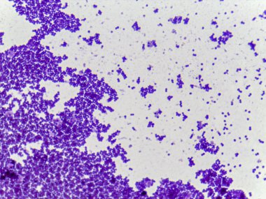 Beyaz zemin üzerinde mor lekeli bakterilerin mikroskobik görüntüsü, sergilenen kümeler ve bireysel hücreler, mikrobiyal çeşitliliği vurguluyor